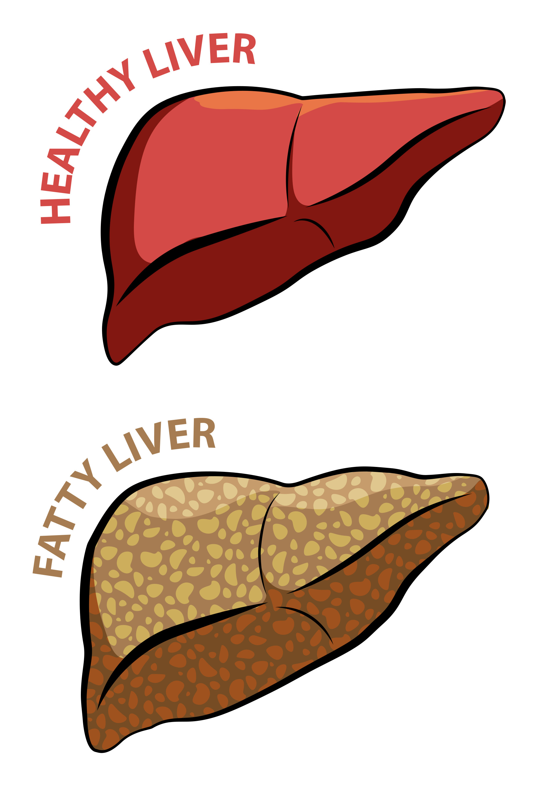 https://mikei.ca/images/Reishi-Mushroom-for-Fatty-Liver-Disease-Fatty-Liver.jpg